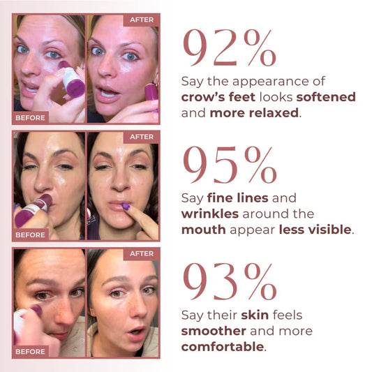 🔥LAST DAY SPECIAL PRICE: €15.99!!💝 #1 Bestselling🏆-Calcium Multi Balm 💫 Anti-Aging & Firming Korean Skincare Stick