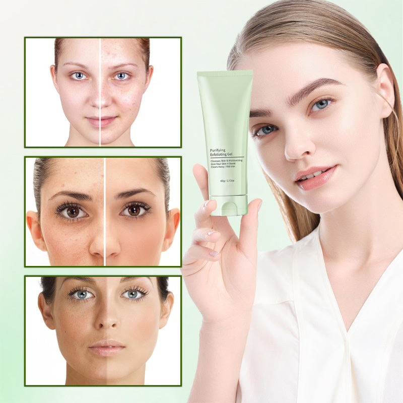 ✨Nieuw binnengekomen zomerartikelen⏳Zachte Exfoliërende, Reinigende Vochtinbrengende Gel/Gentle Exfoliating Cleansing Moisturizing Gel