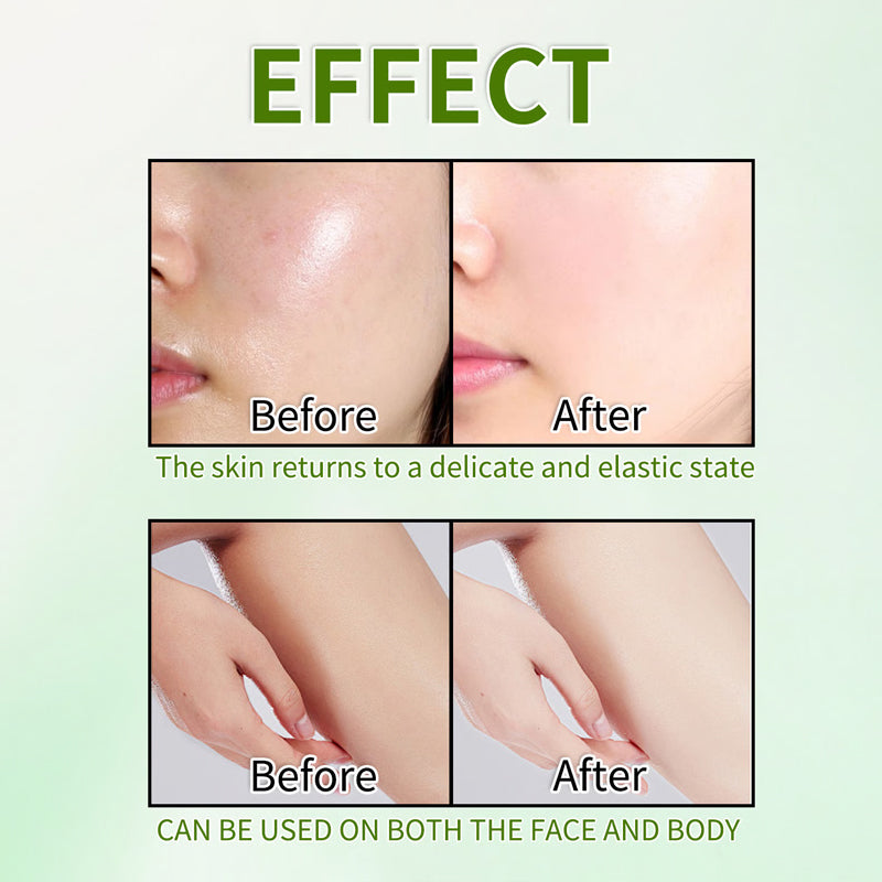 ✨Nieuw binnengekomen zomerartikelen⏳Zachte Exfoliërende, Reinigende Vochtinbrengende Gel/Gentle Exfoliating Cleansing Moisturizing Gel