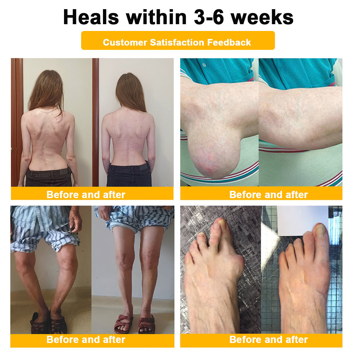 ⏰FLASH SALE: 59% KORTING🔥HOOMWELL™ Botox en bijengif pijnstillende bothelende crème