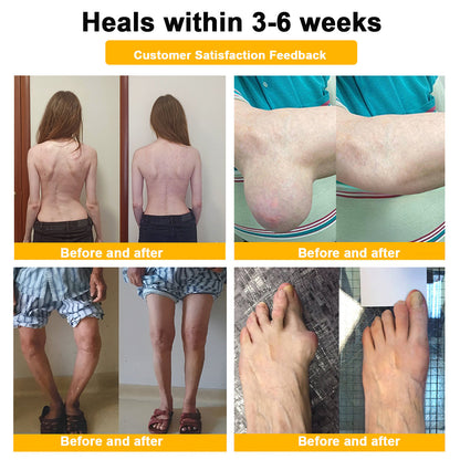 ⏰FLASH SALE: 59% KORTING🔥HOOMWELL™ Botox en bijengif pijnstillende bothelende crème