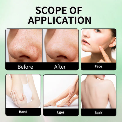 ✨Nieuw binnengekomen zomerartikelen⏳Zachte Exfoliërende, Reinigende Vochtinbrengende Gel/Gentle Exfoliating Cleansing Moisturizing Gel