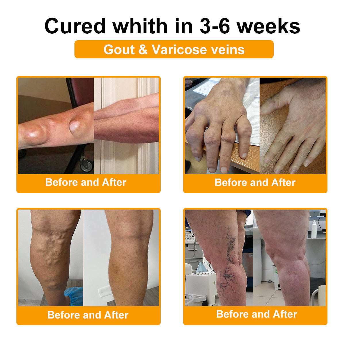 ⏰FLASH SALE: 59% KORTING🔥HOOMWELL™ Botox en bijengif pijnstillende bothelende crème