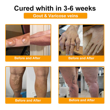 ⏰FLASH SALE: 59% KORTING🔥HOOMWELL™ Botox en bijengif pijnstillende bothelende crème