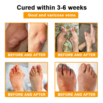 ⏰FLASH SALE: 59% KORTING🔥HOOMWELL™ Botox en bijengif pijnstillende bothelende crème