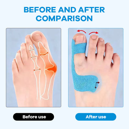 Voorgesneden kinesiologietape voor hallux valgu