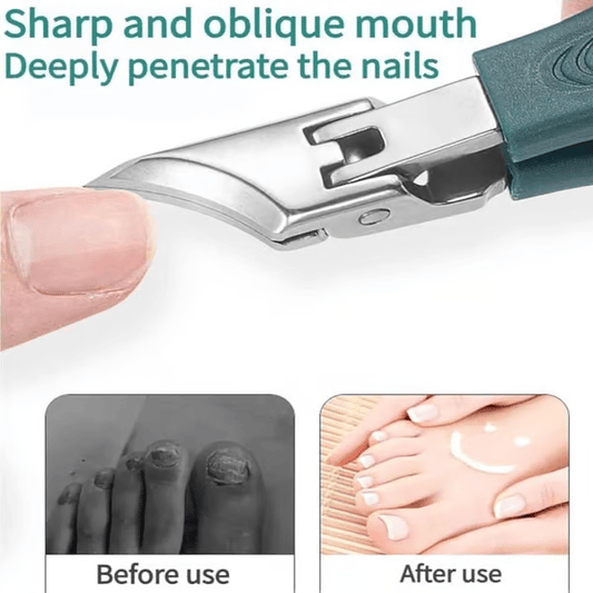🔥Eagle Beak schuine nagelknipper, 3-delige set