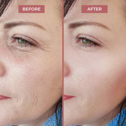 🔥LAST DAY SPECIAL PRICE: €15.99!!💝 #1 Bestselling🏆-Calcium Multi Balm 💫 Anti-Aging & Firming Korean Skincare Stick