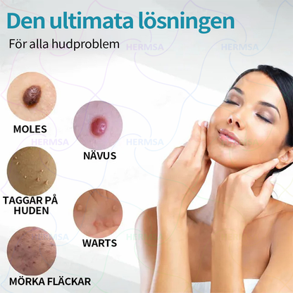 Hermsa® Niet-invasieve Laserpen - Geboortevlek en wratten verwijderen(🔥Laatse dag 80% ALE)