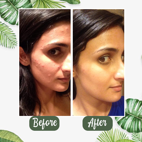 Reinigend gezichtsmasker met ontgiftende groene thee