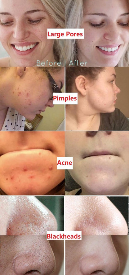 Reinigend gezichtsmasker met ontgiftende groene thee