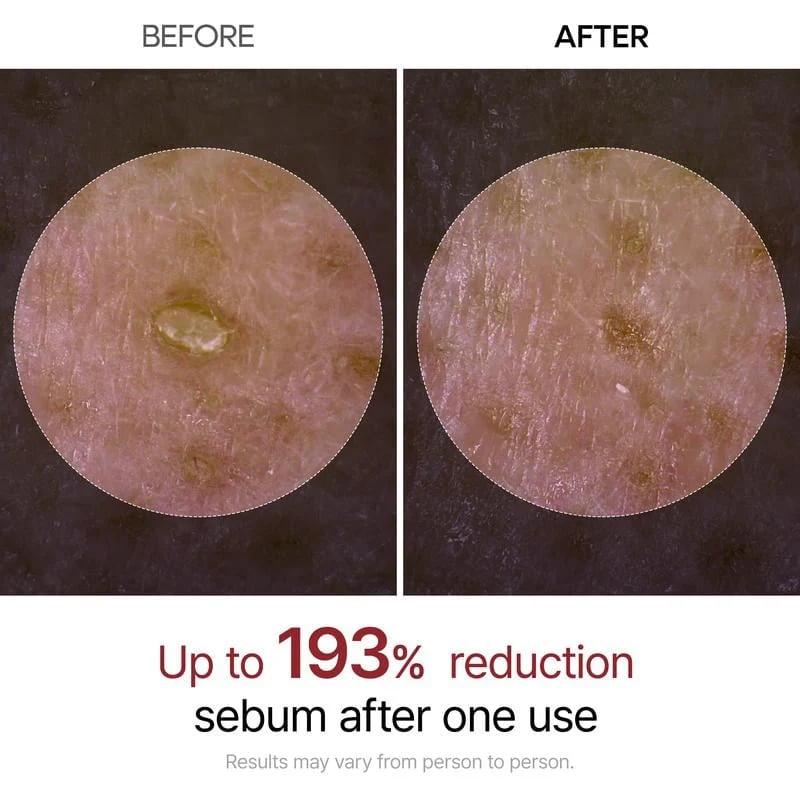 🏆Flash Sale⚡ 50K+ VERKOCHT! Bijna Weg-💥🔥Peel Shot Glow Rijst Ampul Duo