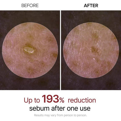 🏆Flash Sale⚡ 50K+ VERKOCHT! Bijna Weg-💥🔥Peel Shot Glow Rijst Ampul Duo