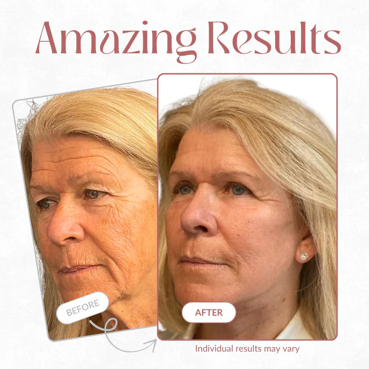🔥LAST DAY SPECIAL PRICE: €15.99!!💝 #1 Bestselling🏆-Calcium Multi Balm 💫 Anti-Aging & Firming Korean Skincare Stick